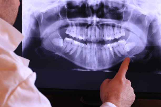 Best Weekend Emergency Dentist in Battle Ground, WA